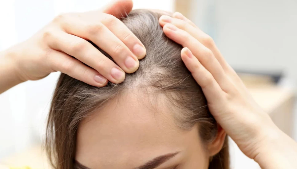 How Manufacturers Can Use Rosemary Oil to Combat Hair Loss