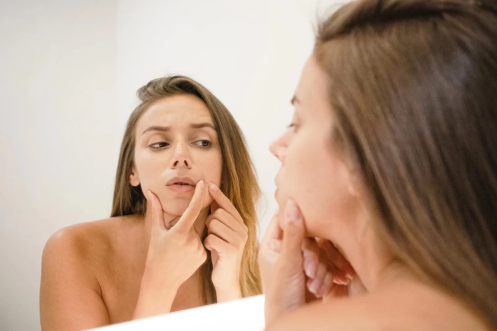 Herbal Extracts to Help Remove Blackheads on the Skin