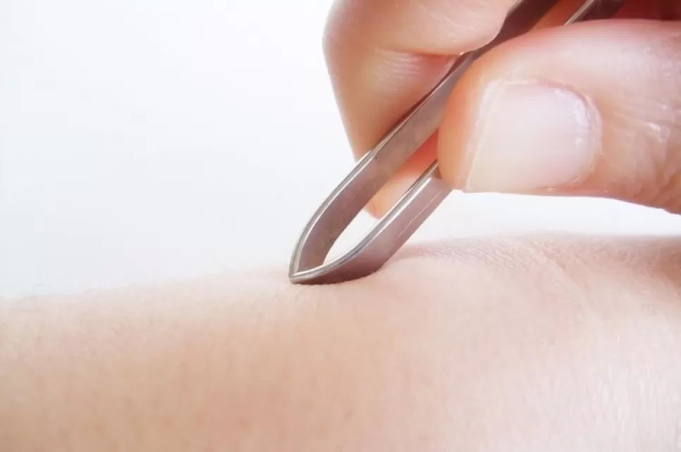 Greenext G25 Complex ile İstenmeyen Tüy Karşıtı Bitkisel Denge