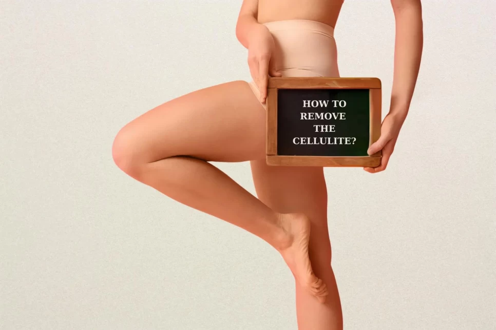 How To Remove The Cellulite?