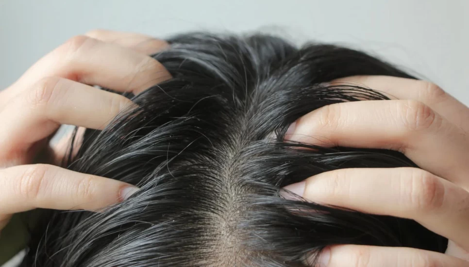 How to Use Rosemary Oil for Oily Hair – Scientifically Proven