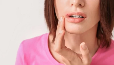 Biberiye Yağı Uçuğa İyi Gelir mi?