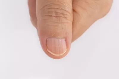 Natural Nail Care Oil | Bitkisel Tırnak ve Tırnak Eti Bakımı