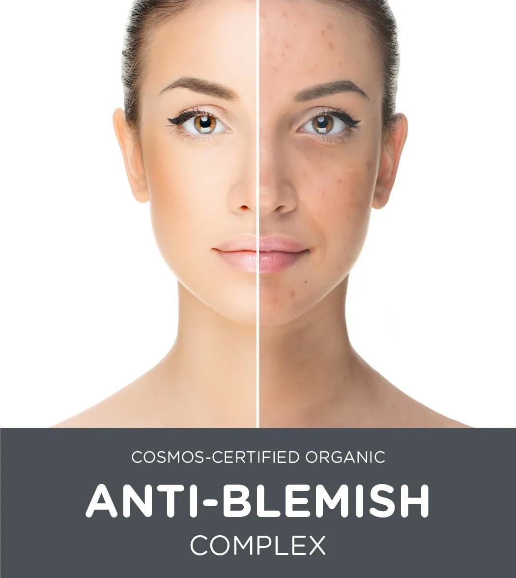 ORGANİK ANTI-BLEMISH KOMPLEKS